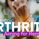 Rheumatoid ARTHRITIS Aiming for Remission